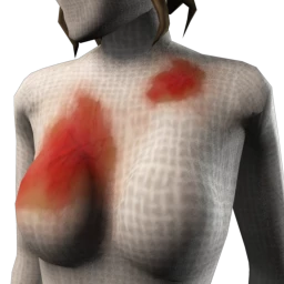 Cosmos Zombie Wounds - Bruise