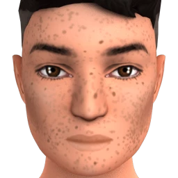 Impression Contour (Plentiful Freckles) - Light