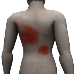 Cosmos Zombie Wounds - Bruise